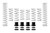 Eibach 18-19 Polaris RZR XP Turbo (Fox Dynamix Pro-UTV) Stage 2 Performance Spring System (Set of 8)