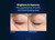 PCA Skin Microneedle Eye Patches - set of 4 - Elite Retreat - before and after 3