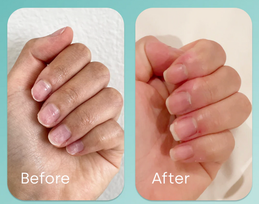 BioSil for nails