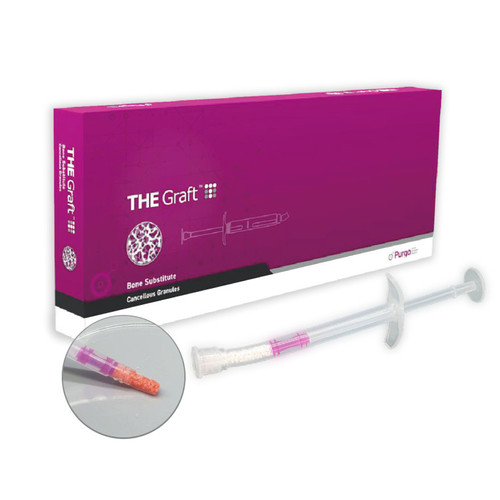 THE Graft Syringe 0.25-1.0mm  (0.25cc)