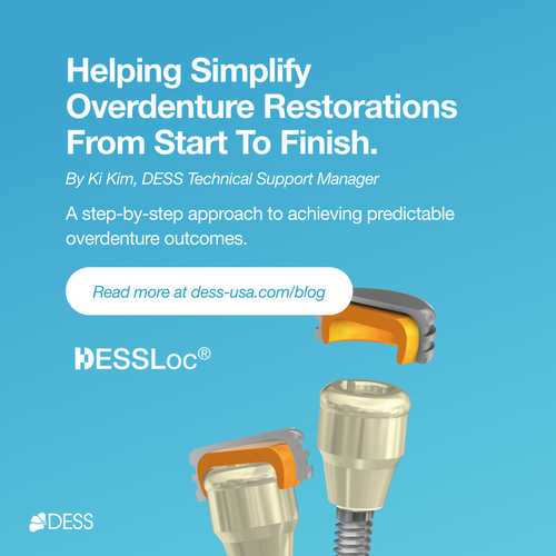 The Complete Guide to DESSLoc® Workflows