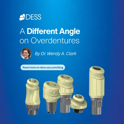 A Different Angle on Overdentures