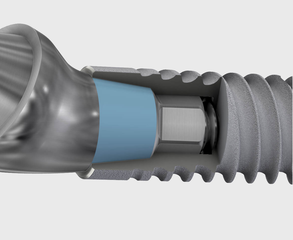 One Connection For All Implant Diameters