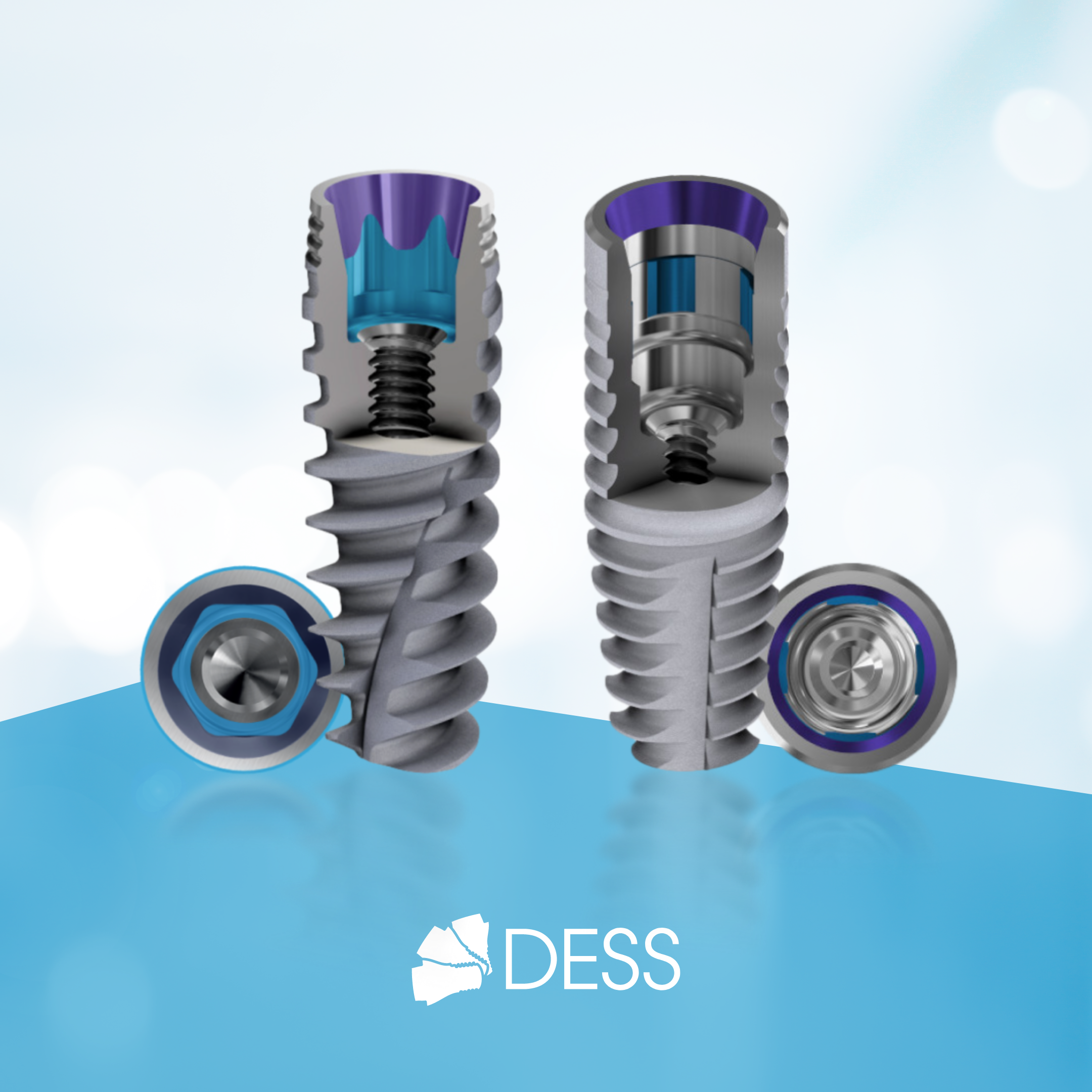 DESS® Implants: ACTIVE HEX and CONICAL BLT – Innovation with a Sustainability Intention