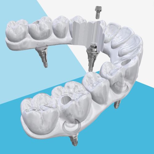 Proven Benefits of DESS® Flat Seat Screw