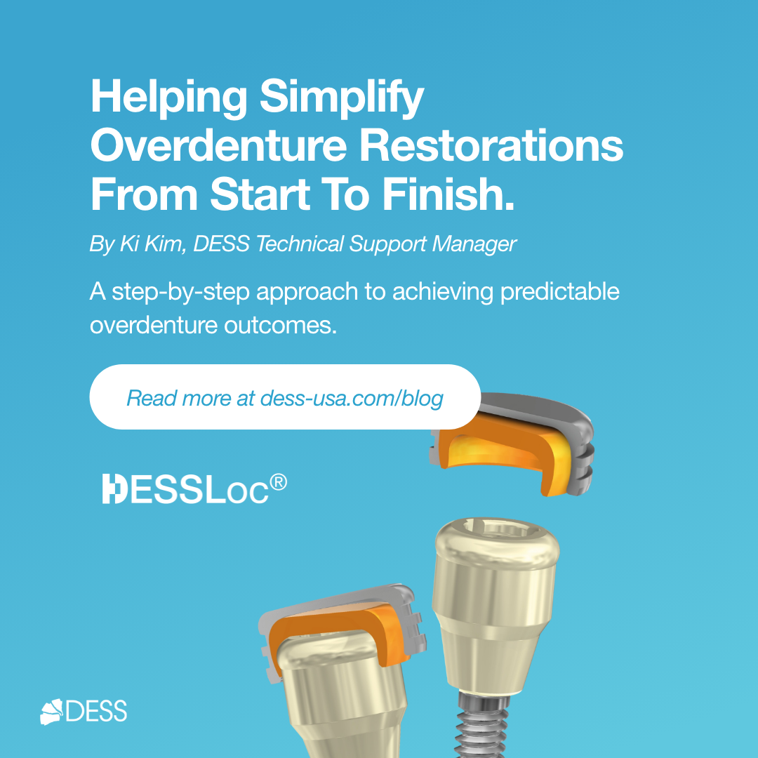 The Complete Guide to DESSLoc® Workflows