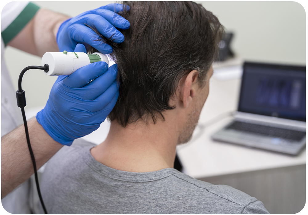 ANALISIS CAPILAR IMAGEN 1