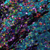 Tissue stained with 3 OPAL reagents and spectral DAPI