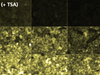 Tyramide Signal Amplification (TSA) stained tissue.