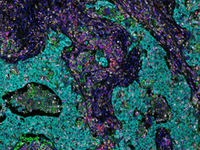 Tissue stained with Opal 480 and other Opal reagent packs Tissue stained with Opal 480 and other Opal reagent packs