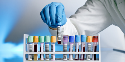 From our partners at Quanterix, a summary on Tau as a vital biomarker in Severe Traumatic Brain Injury. From our partners at Quanterix, a summary on Tau as a vital biomarker in Severe Traumatic Brain Injury.