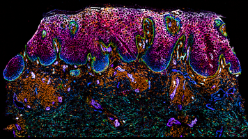 Spatial Phenotyping with Akoya Biosciences