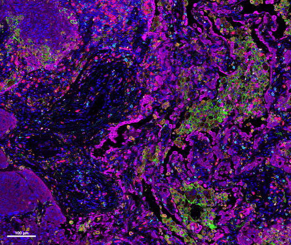 7 colour OPAL stained tissue.