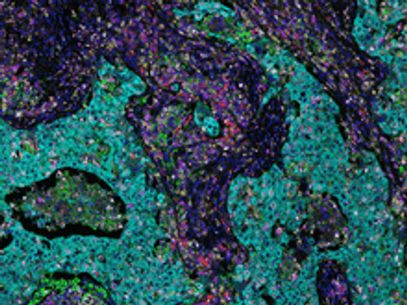 Tissue stained with a variety of Opal reagents, including Opal 780