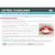 TCA Lip Peel Kit for upper and lower smokers lines, marionette lines and nasal labial folds. 