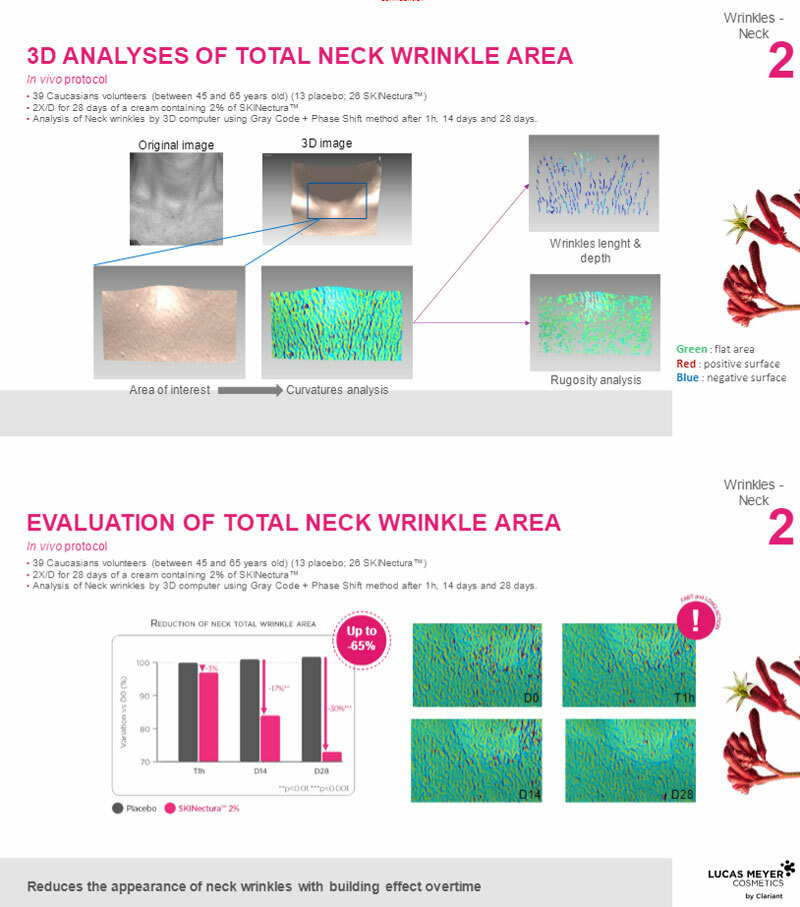 3d-neck-analysis.jpg 3d-neck-analysis.jpg