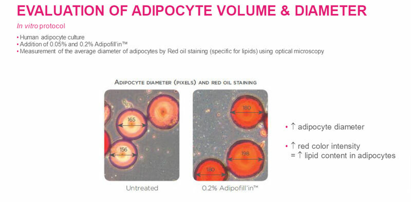 adipocyte-volume.jpg