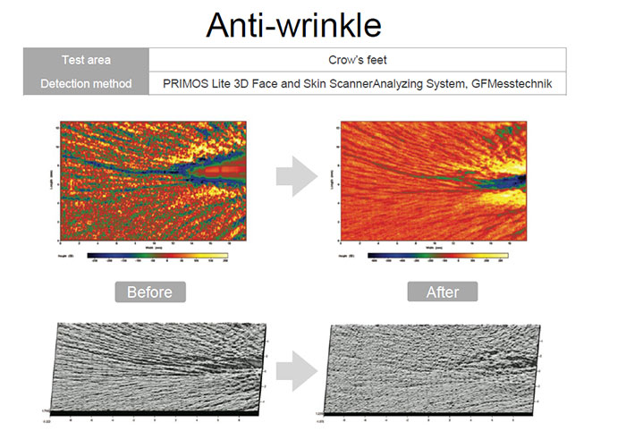 bioplacenta crows feet study on 12 women aged 43 to 50 years