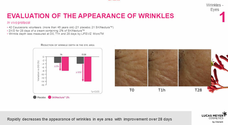 eye-wrinkles.jpg eye-wrinkles.jpg