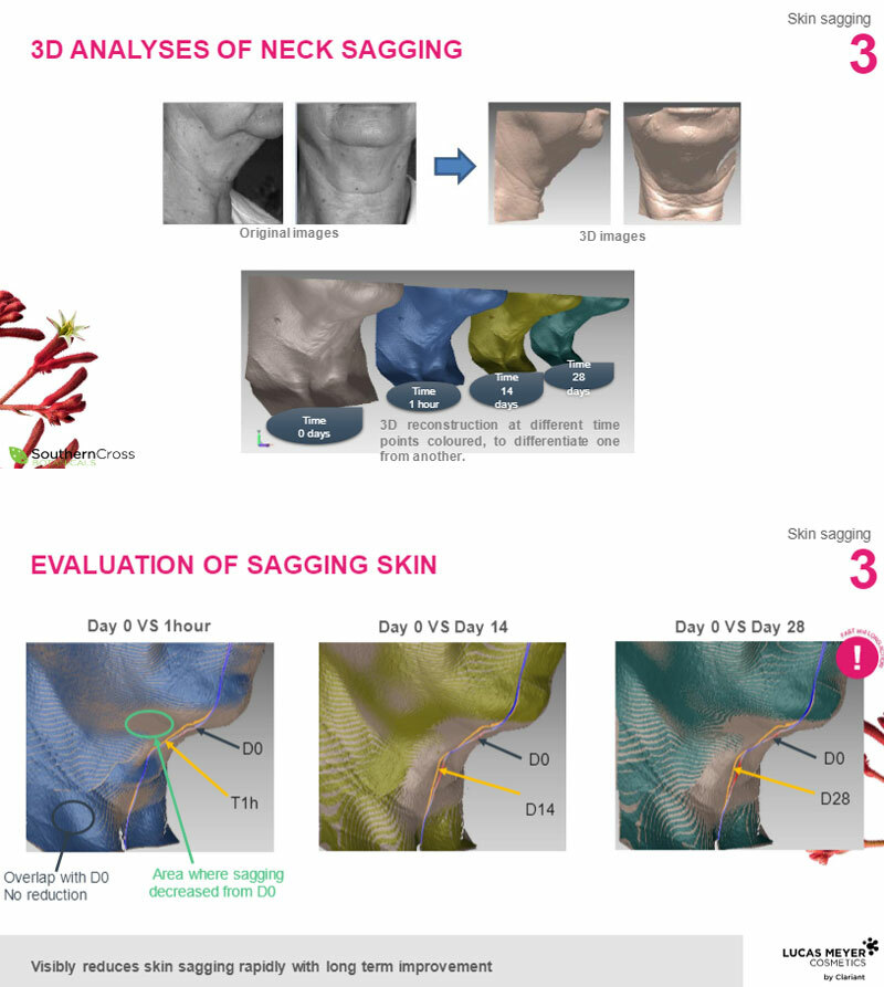 sagging-neck-evaluation.jpg sagging-neck-evaluation.jpg