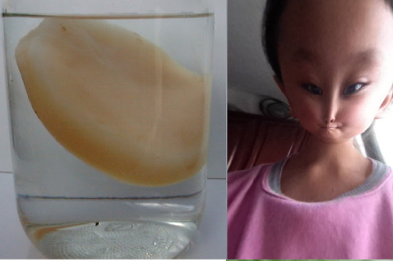 Why Kombucha Mushrooms sink or float.