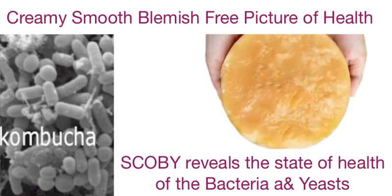 Spotlight: SCOBY and Bacteria – MOMO Kombucha