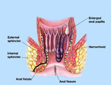 Can You Use Numbing Cream for Anorectal Disorders?