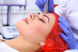 Say ‘Hi’ To Youthful Skin with Microdermabrasion