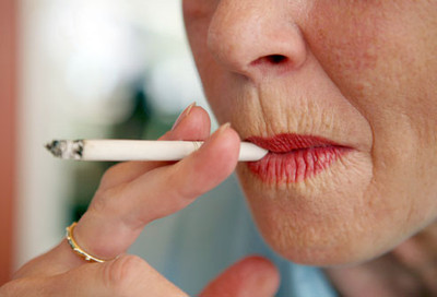 5 Reasons Causing Smokers Lines On Your Face 