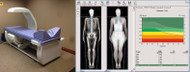 What Is a DEXA Body Composition Scan?