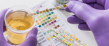 Drug Tests and CBD
