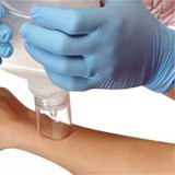 Bsn Medical - Splashcap - 10015 - Wound Irrigation Shield 