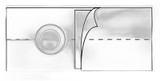 Nu-Hope - Nu-Form - 6333-P-R - Nuform Belt Prolapse - Each