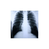 Mckesson - Clear Choice Performance - 55Oze - Film, Xray Grn 9.5 X 11.75 - Case/500