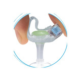 Applied Medical - Minione - M1-5-1855-I - Technology - Low Profile Balloon Button Gastrostomy Tube Kit 18 Fr 5.5 Cm Silicone Sterile