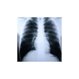 Mckesson - Clear Choice Performance - 58K4V - Film, Xray Hi - Spd Blu 14X17