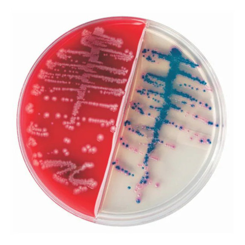 Bd Becton Dickinson - Bbl Chromagar - 222239 - Prepared Media Trypticase Soy Agar With 5% Sheep Blood (Tsa Ii) / Orientation Light Beige Liquid - Package/100
