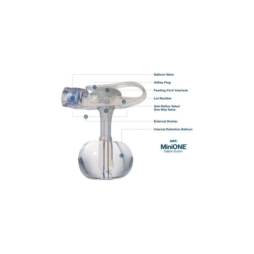 Applied Medical - Minione - M1-5-1450-I - Technology - Technologies - Low Profile Balloon Button Gastrostomy Tube 14 Fr 5 0 Cm Silicone - Each