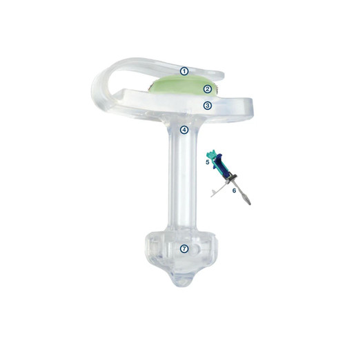 Applied Medical - Minione - M1-1-1425-I - Low Profile Non - Balloon Button Gastrostomy Tube 14 Fr 2.5 Cm Silicone - Each
