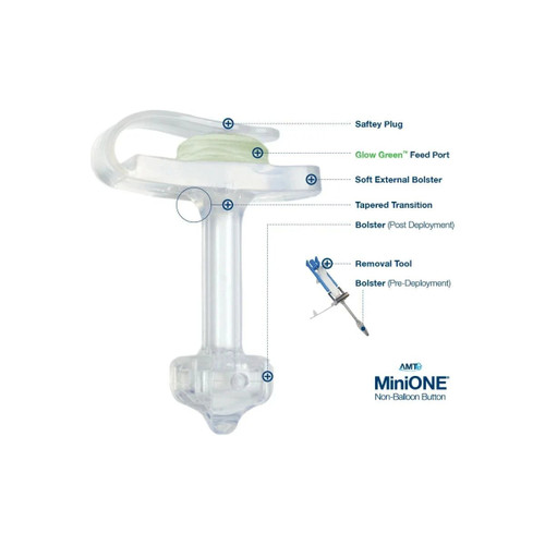 Applied Medical - Minione - M1-1-1834-I - Technology - Low Profile Non - Balloon Button Gastrostomy Tube Kit 18 Fr 3.4 Cm Silicone Sterile
