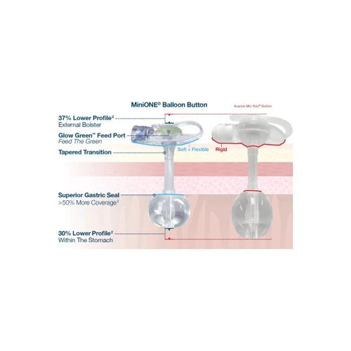 Applied Medical - Minione - M1-1-1430-I - Technology - Low Profile Non - Balloon Button Gastrostomy Tube Kit 14 Fr 3.0 Cm Silicone Sterile