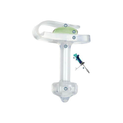 Applied Medical - Minione - M1-5-1480-I - Tech Mini One Balloon Button Kit With Enfit Connector, 14 Fr X 8.0 Cm.The Has An Internal Retention Exclusive Apple Shape That Keeps The Device In Place For Insertion And Removal, Th