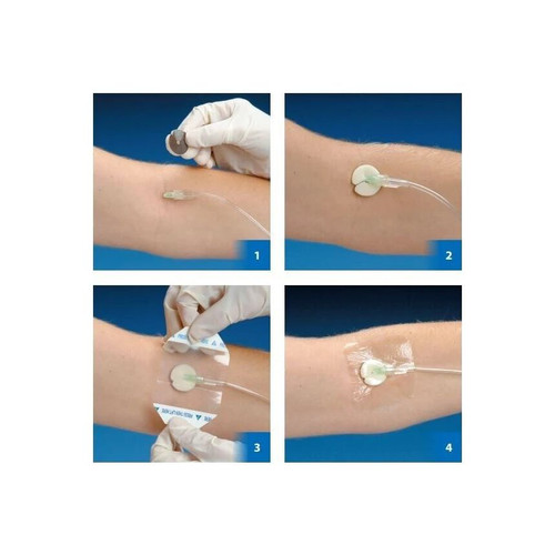 Deroyal - 46-Iv20 - Algidex Iv Patch Catheter Dressing, Size 34In (, Case)