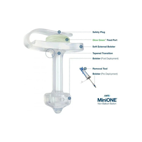 Applied Medical - Minione - M1-1-2434-I - Technology Low Profile Non - Balloon Button Gastrostomy Tube Kit 24 Fr 3.4 Cm Silicone Sterile