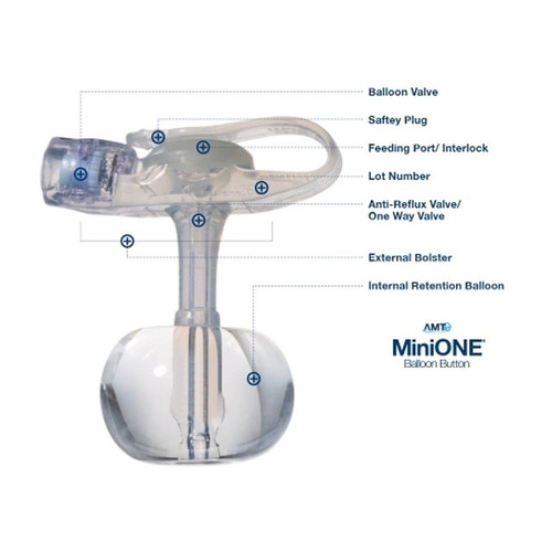 Applied Medical - Minione - M1-5-1435 - Technology - Technologies - Balloon Button Gastrostomy Feeding Device 14 Fr 3.5 Cm Tube Silicone Sterile