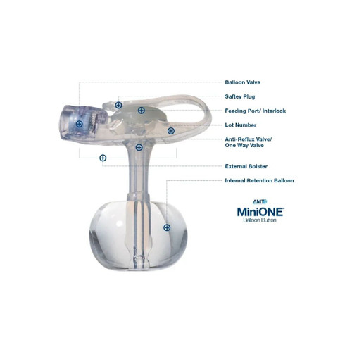Applied Medical - Minione - M1-5-1455-I - Technology - Technologies - Low Profile Balloon Button Gastrostomy Tube 14 Fr 5.5 Cm Silicone