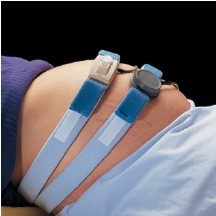 Deroyal - M1132-10 - Fetal Monitor Strap Abdominal, Blue Purr Foam, With Slot
