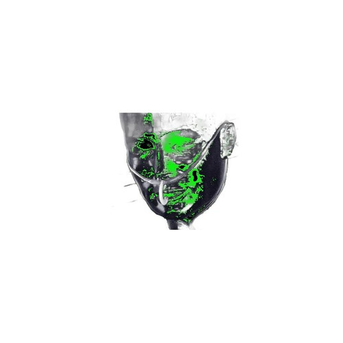 Sun Med - Salter-Style - 4797F-7-7-25 - 7 - 25 - Oral - Trac Etco2 / Nasal Sampling Cannula With O2 Delivery Oxygen Adult Curved Prong Nonflared Tip