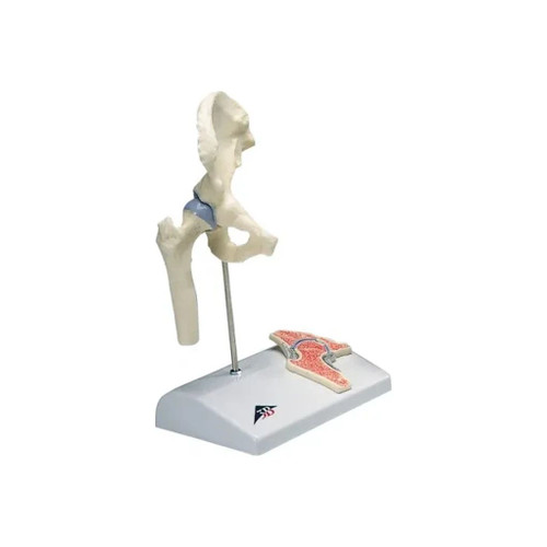 Fabrication Enterprises - 12-4517 - Anatomical Model - mini hip joint with cross section of bone on base