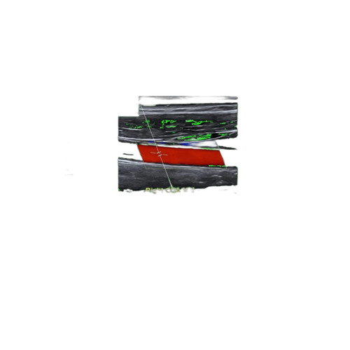 Ge Healthcare - H47591Pj - Viewpoint Volume Modalty License Gulfport For Use With Vivid Iq